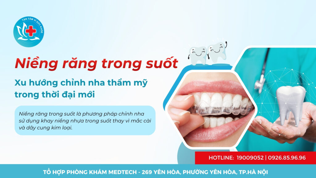 Niềng răng trong suốt: Xu hướng chỉnh nha thẩm mỹ