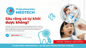 Sâu răng có tự khỏi không?